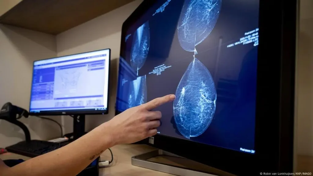 New AI Method May Help In Early Breast Cancer Detection